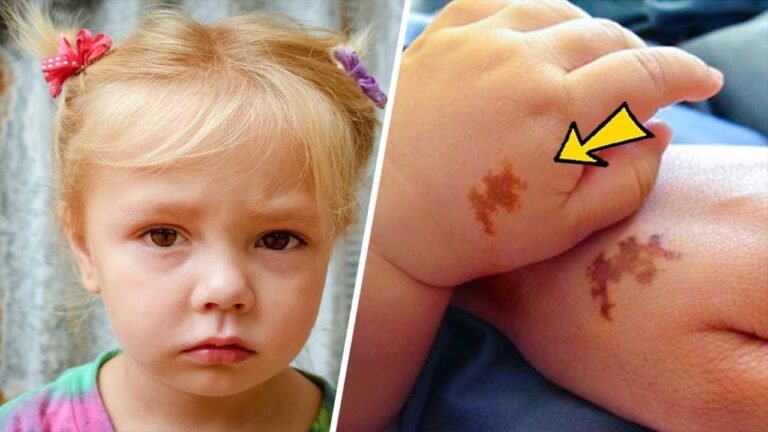 Mom adopts girl with same birthmark as her’s, doing a