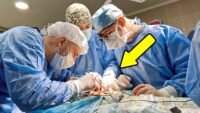 The woman turned with kidney pain! But, THE SURGEONS did