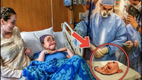 This Woman Had Americas First Face Transplant. Then Nine Years On She Shared Her Inspiring Story.jpg